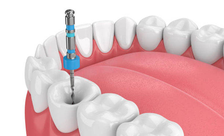dental clinic in abudhabi