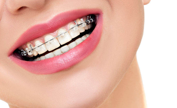 dental clinic in abudhabi