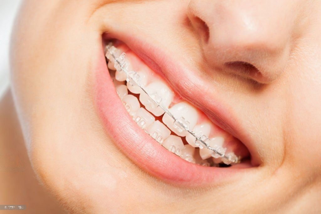 Orthodontist in Abu Dhabi