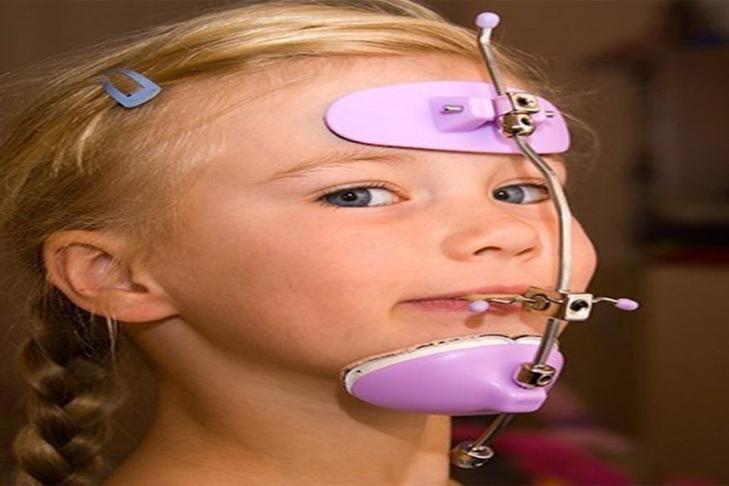 Orthodontist in Abu Dhabi