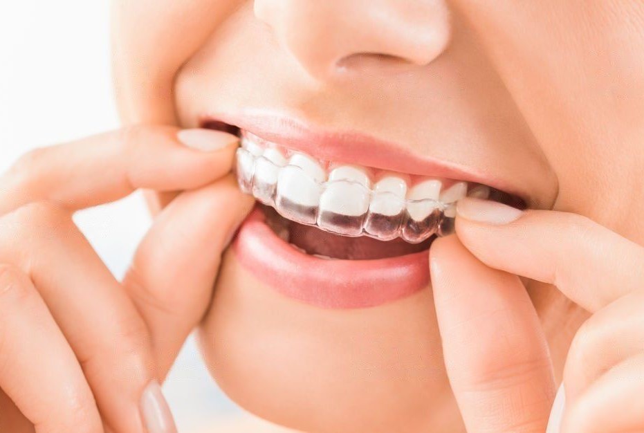 Orthodontist in Abu Dhabi
