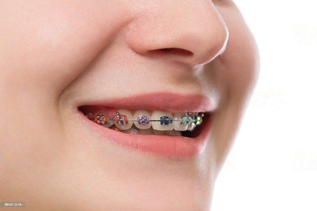 Orthodontist in Abu Dhabi