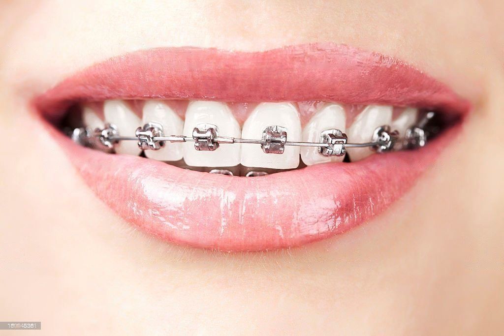 Orthodontist in Abu Dhabi